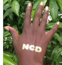 are you NCD+?